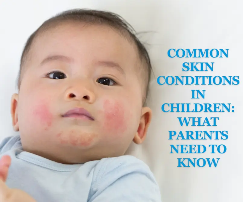 Common Skin Conditions In Children What Parents Need To Know