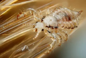 A Crawling Issue Head Lice Treatments Worse Than The Pest Itself