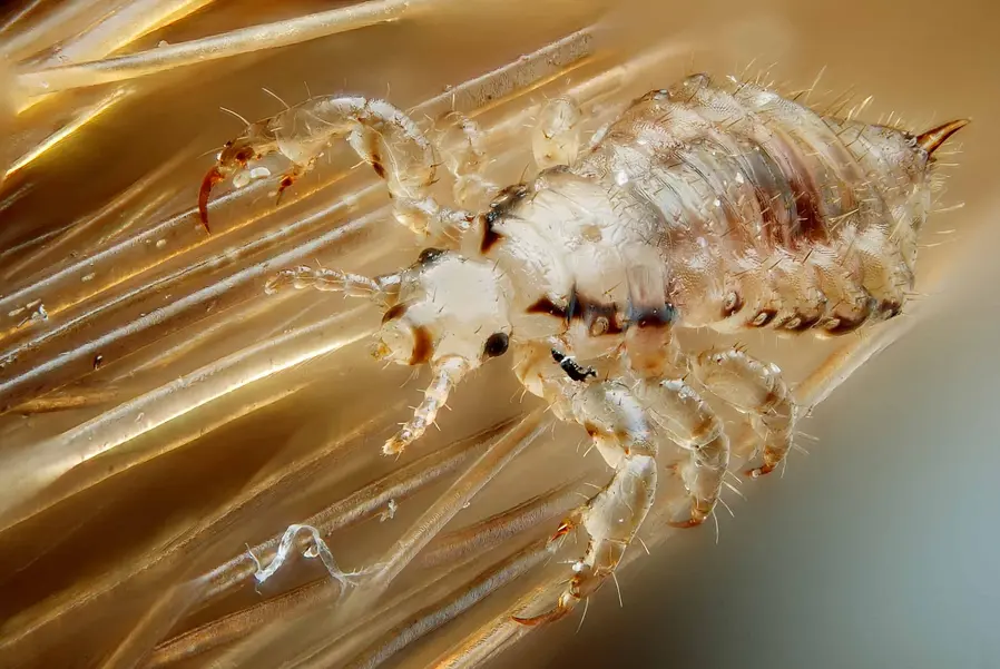 A Crawling Issue Head Lice Treatments Worse Than The Pest Itself