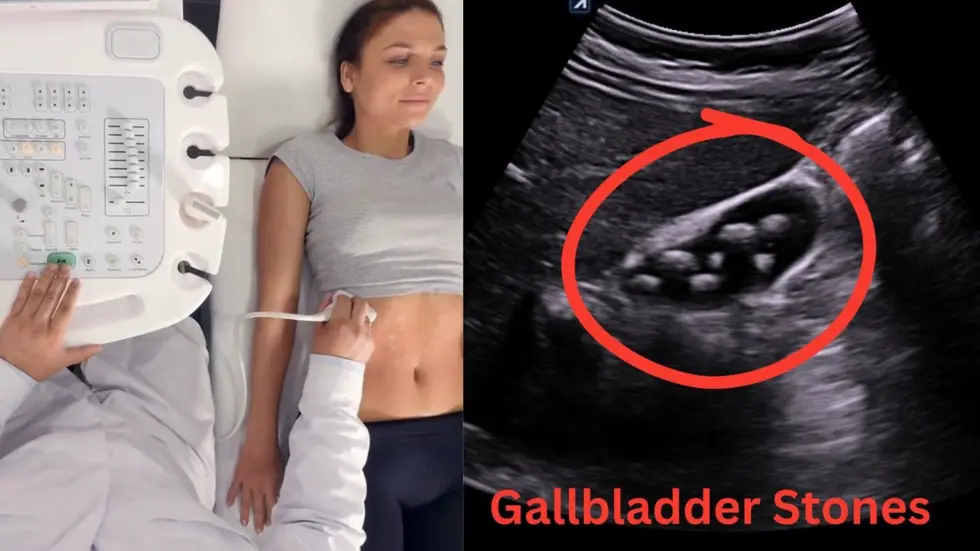 Abdominal Ultrasound Hollywood Fl Stomach Pain Digestion