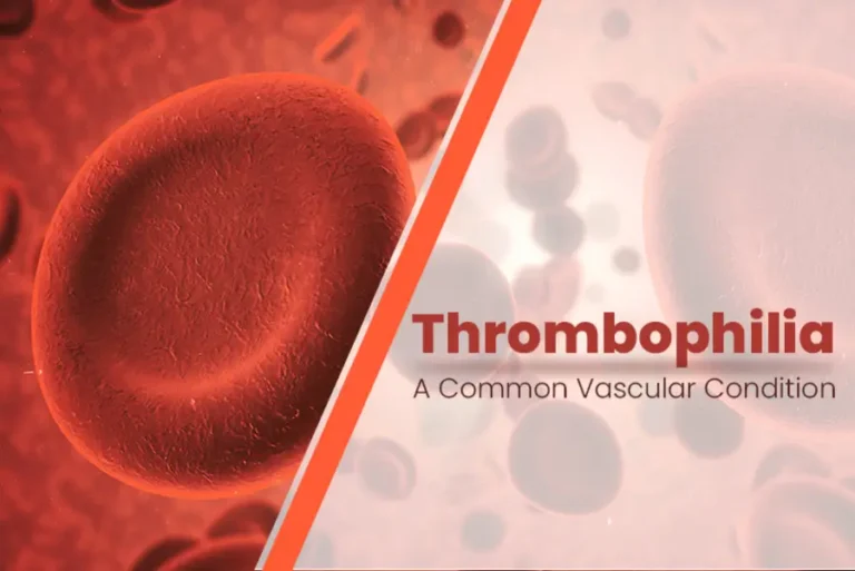 Code Thrombophilia Common Vascular Condition