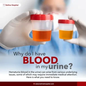 Why Do I Have Blood In My Urine - Sidra Family Hospital Why Do I Have Blood In My Urine
