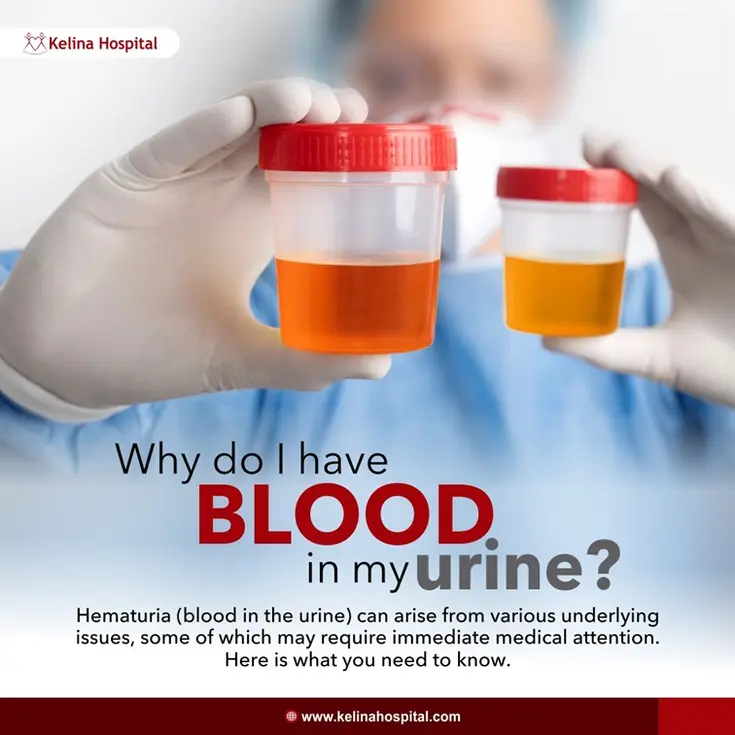 Why Do I Have Blood In My Urine